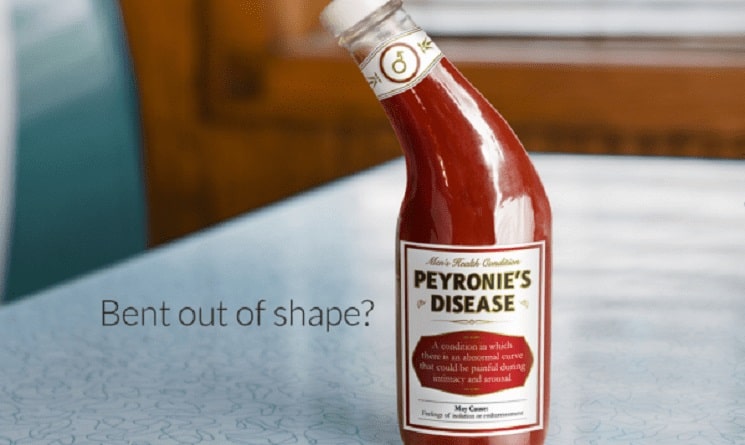 Men Over 65: Senior Adult Sex Talk Time, Peyronie's Disease